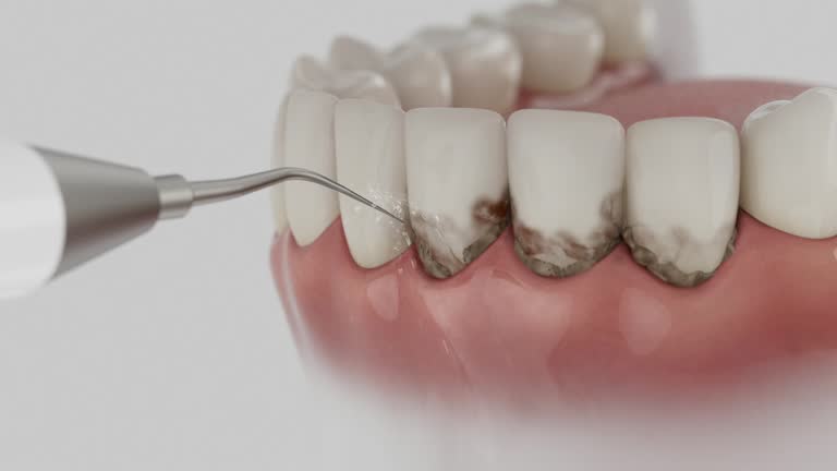 Reliable Dental contractor in Roseville, CA by Smile Center Dentistry
